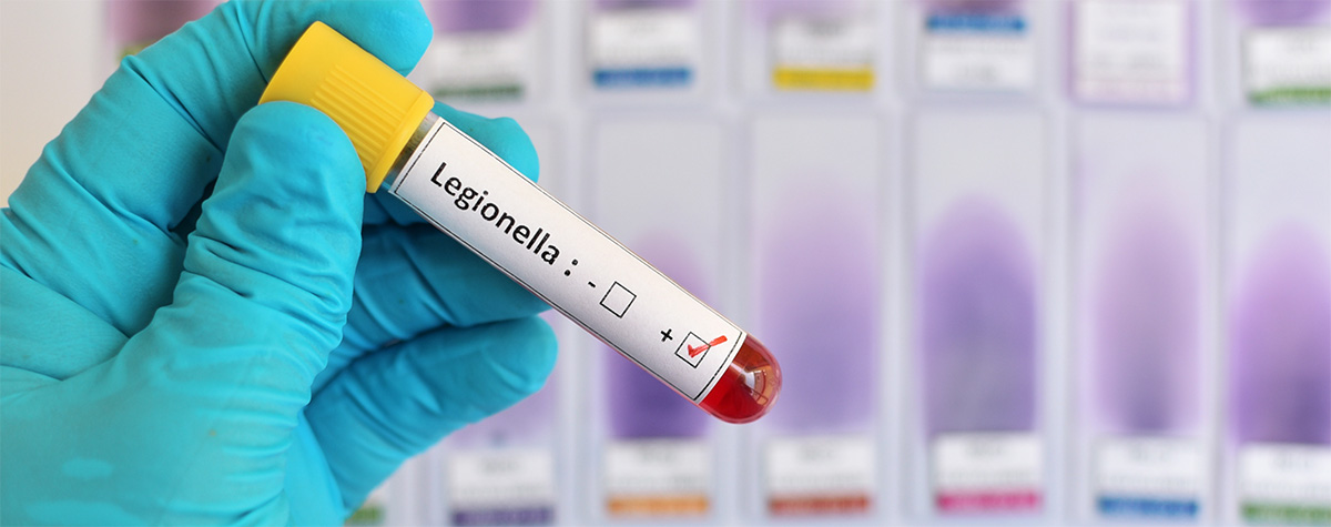 Legionella